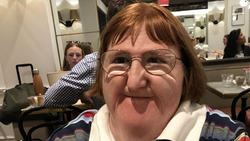 Disability Blogger Trolls Said I Was Too Ugly For Selfies So I Hit 