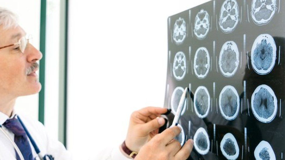 Doctors looking at a series of brain scans