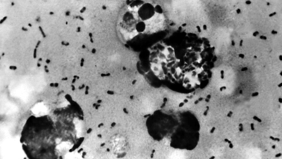 Plague: Ancient teeth reveal where Black Death began, researchers say - BBC News