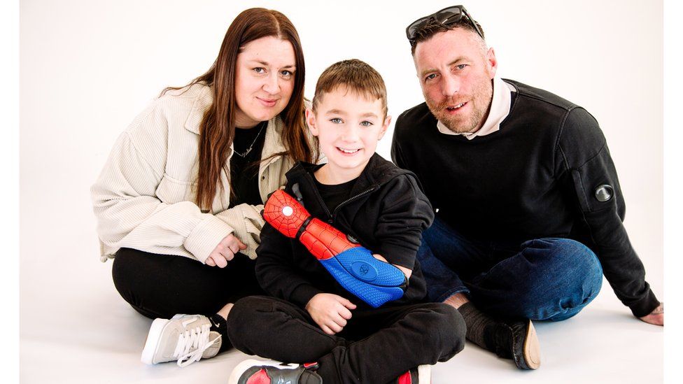 Kaden Taylor with his family wearing his new bionic arm
