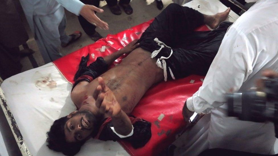 A man injured in a suicide bomb attack against Shia Muslims in Jacobabad, receives medical treatment, 23 October