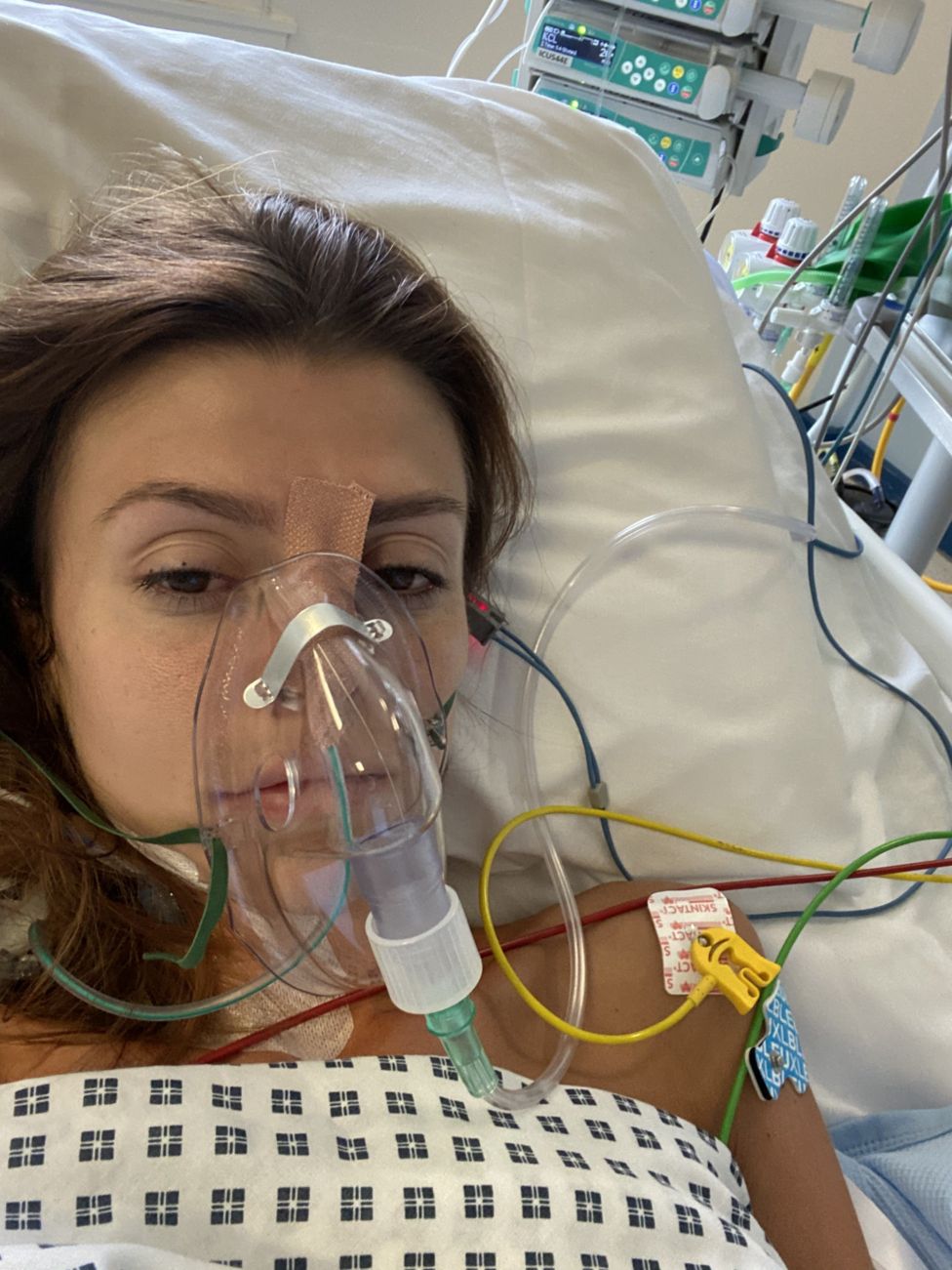 Crohns Patient Vomits 30 Times A Day And Has Cardiac Arrests Bbc News