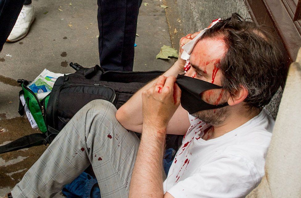 A journalist is treated for a head wound in Westminster after protests in London on 3 June