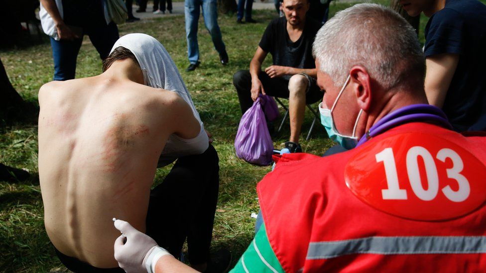 Doctors provide medical treatment to people, who were reportedly tortured and beaten by the police, after being released from a detention centre in Minsk, Belarus, 14 August 2020