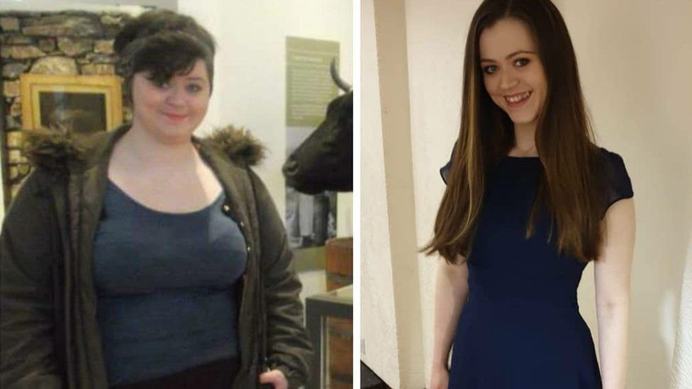 Split screen picture showing Eimi before and after her weight loss