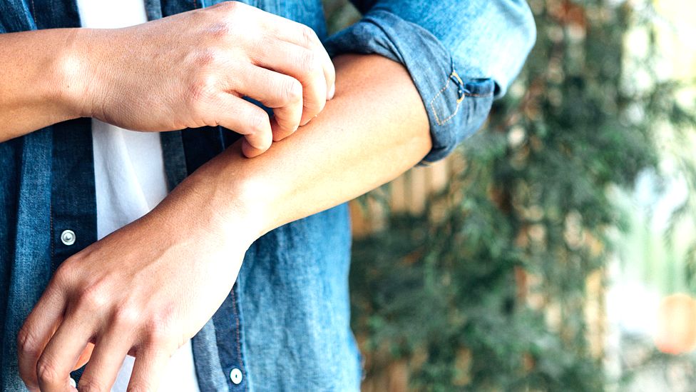 Solving the Mystery of Groin Rashes: What You Need to Know 