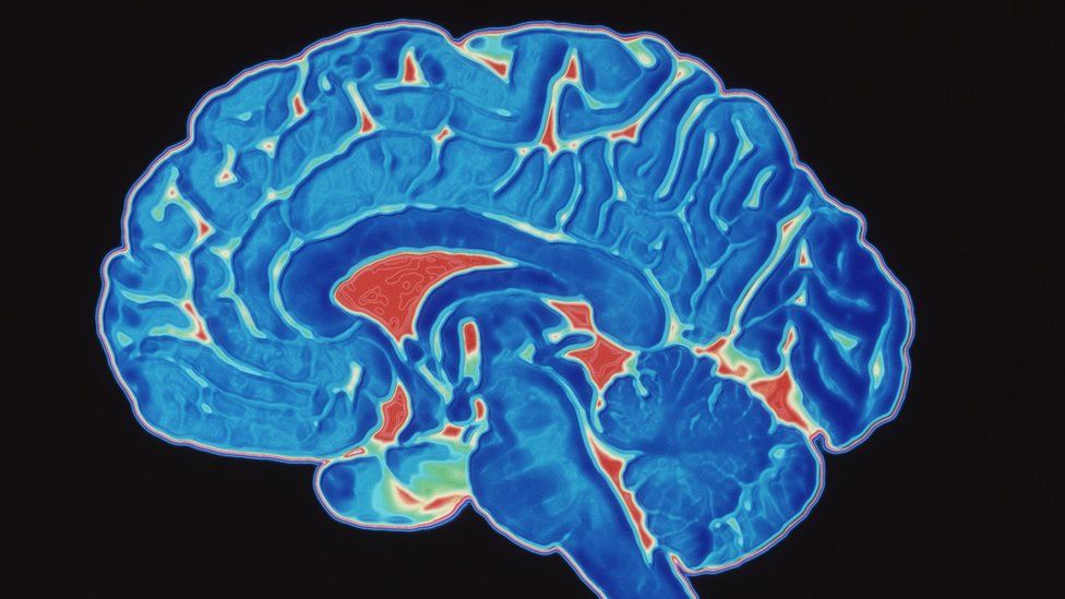 Tourette Syndrome: What is it and how can you help? - BBC Newsround