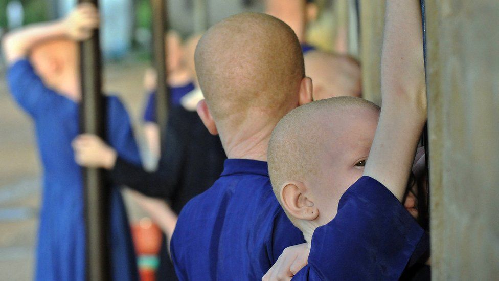 Albino children take a break on January 25, 2009 in a recreational hall at the Mitindo Primary School for the blind, which has become a rare sanctuary for albino children.