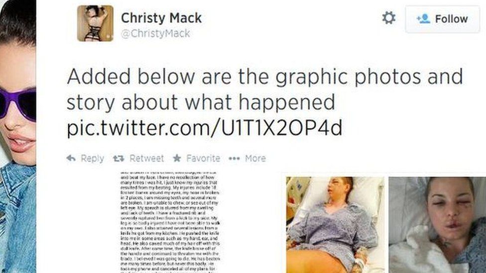 Christy Mack's Twitter post on her injuries.