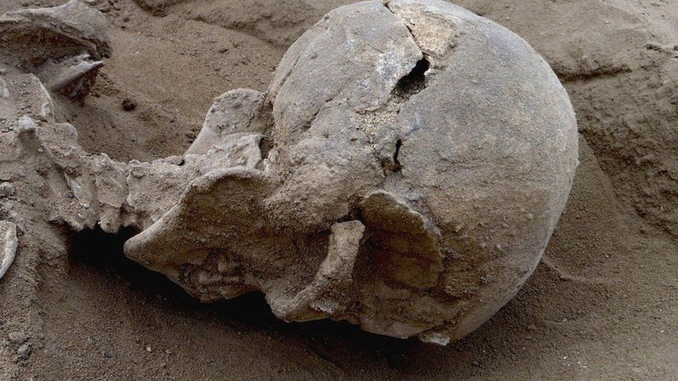 Detail of the skull of the skeleton of a man found lying prone in the sediments of a lagoon 30km west of Lake Turkana, Kenya, at a place called Nataruk