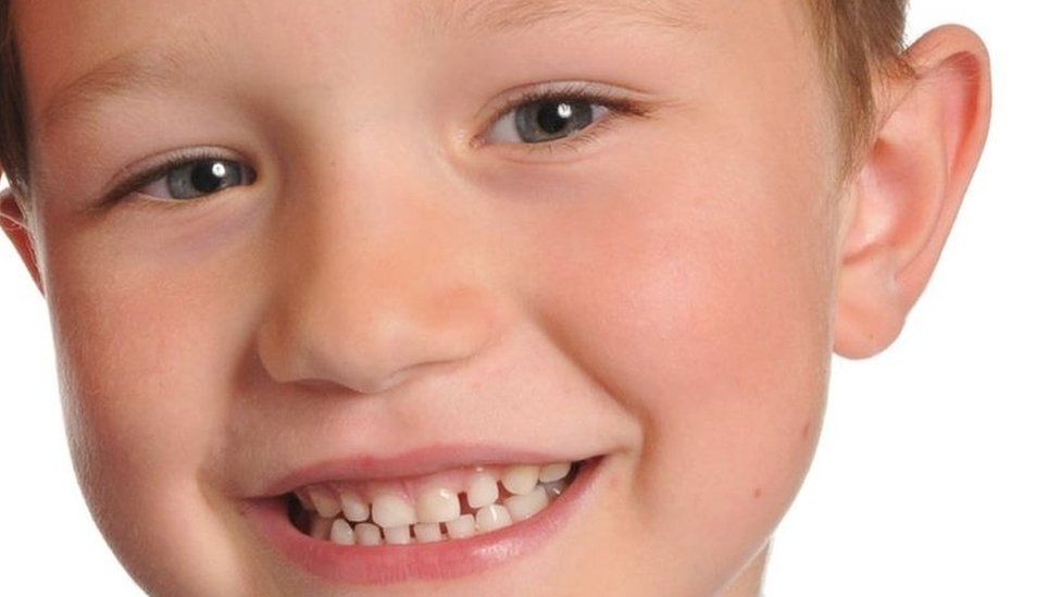 NHS 'missed opportunities' to save boy with green vomit BBC News