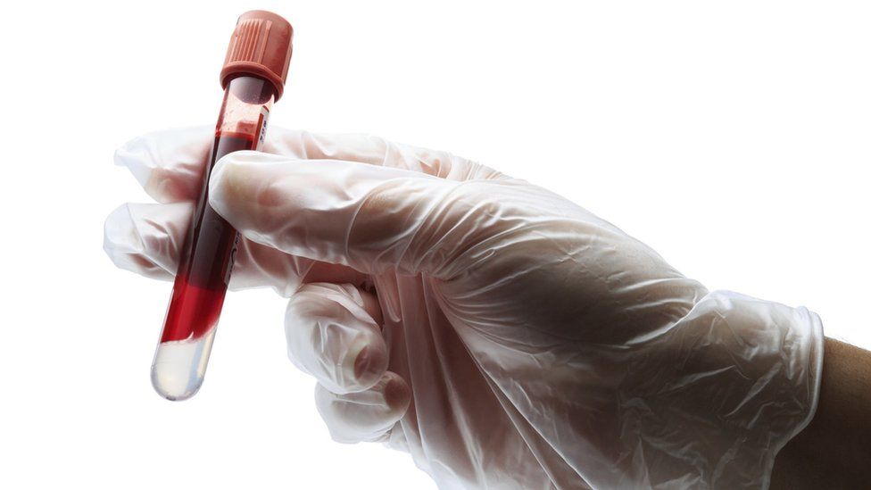 Blood sample