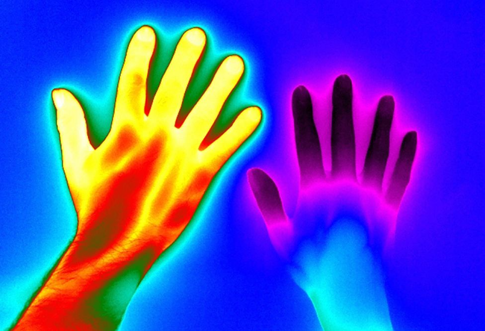 Raynaud's disease - from Matthew Clavey, Thermal Vision Research