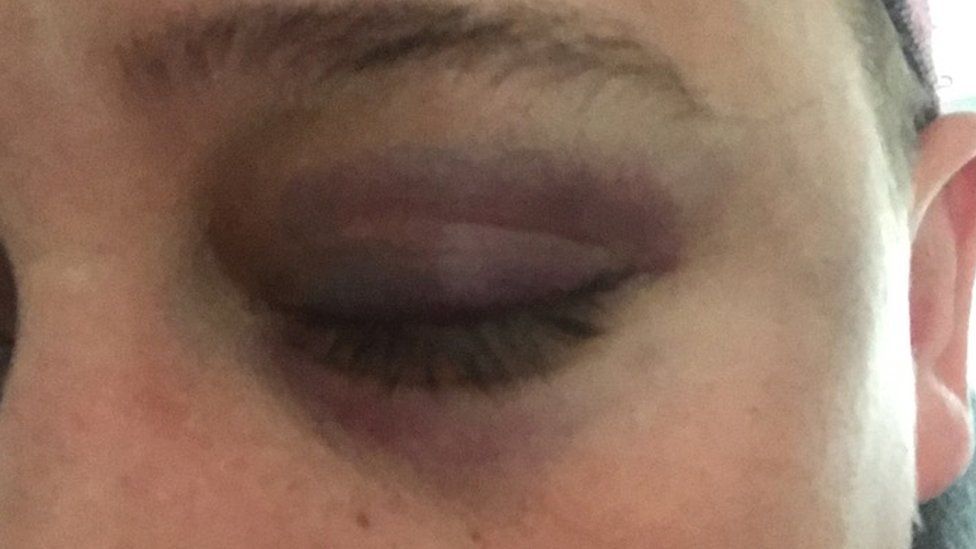 Portsmouth attack victim