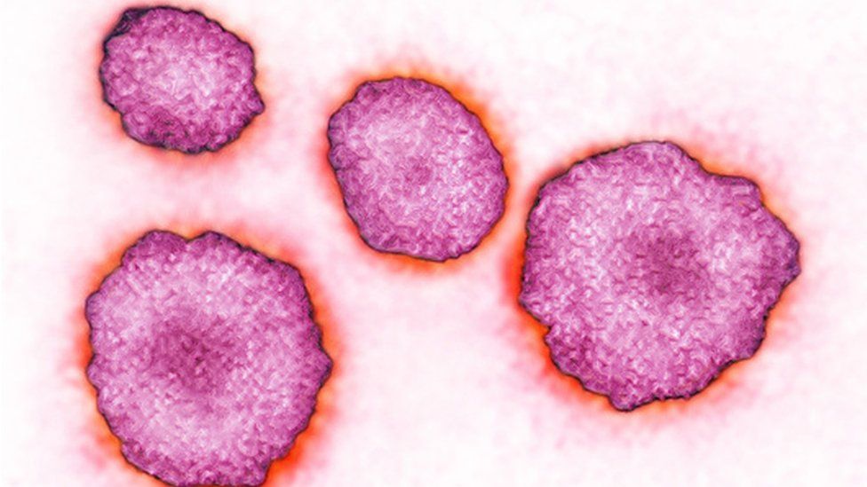 Mumps Is It The Forgotten Disease BBC News