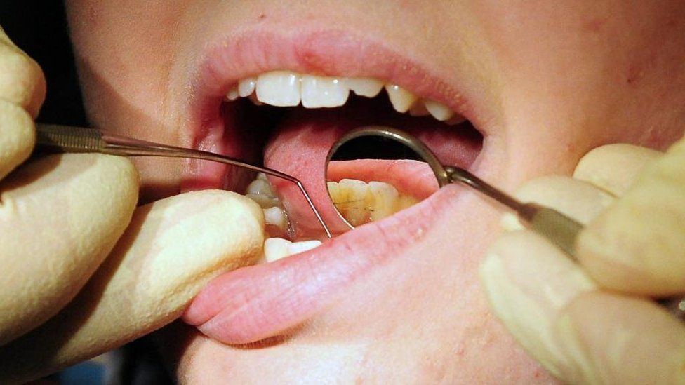 Child's mouth being examined by a dentis