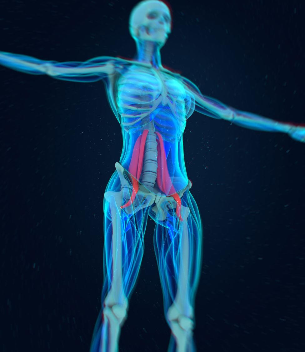 Lesion en el musculo psoas