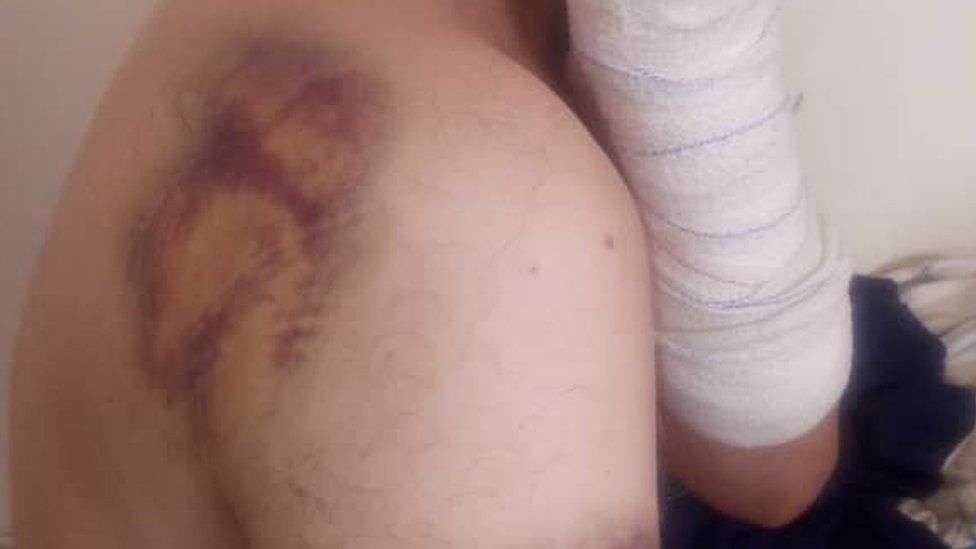 Wounds and bandaged arm of unnamed embassy guard