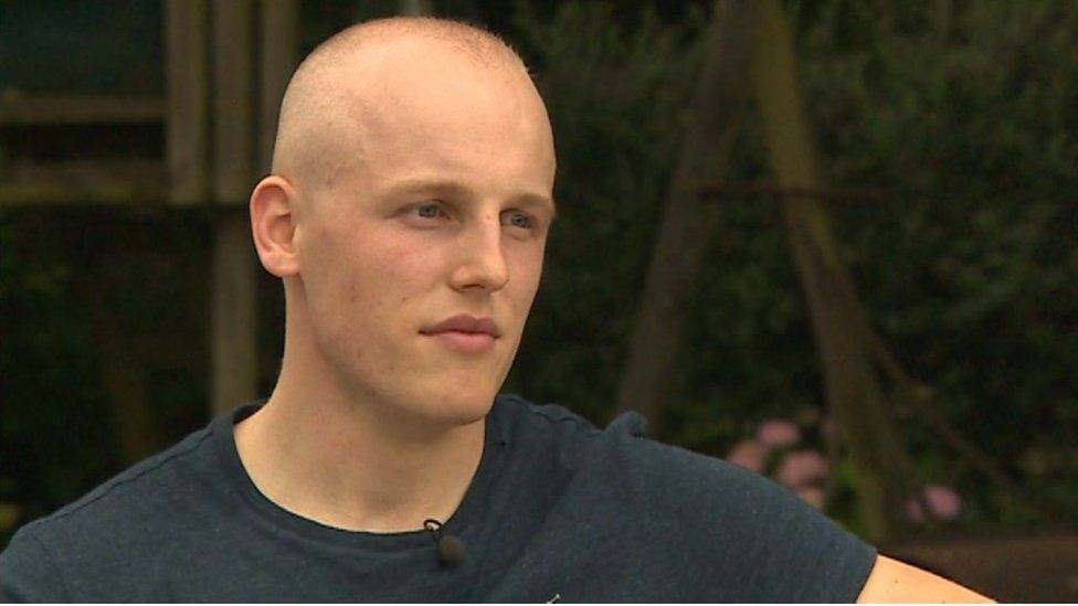 Canser: 'Dynion ddim yn gofyn am gymorth colli gwallt' - BBC Cymru Fyw