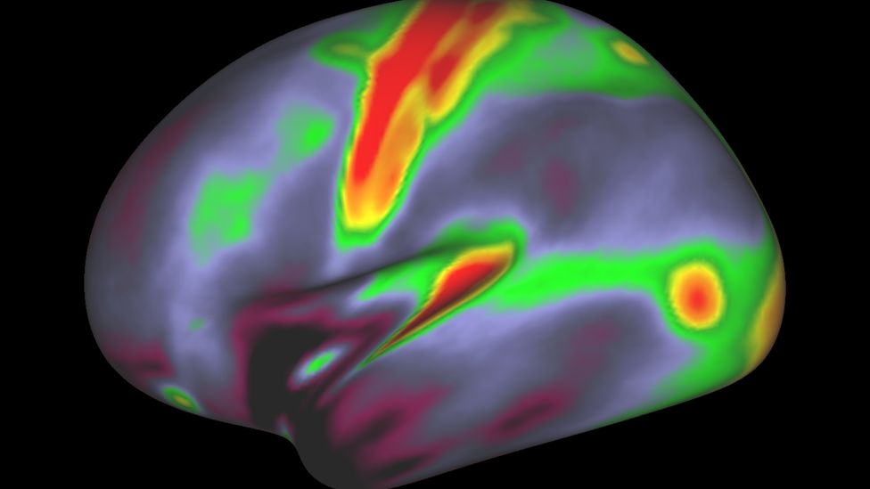 map of myelin in the brain