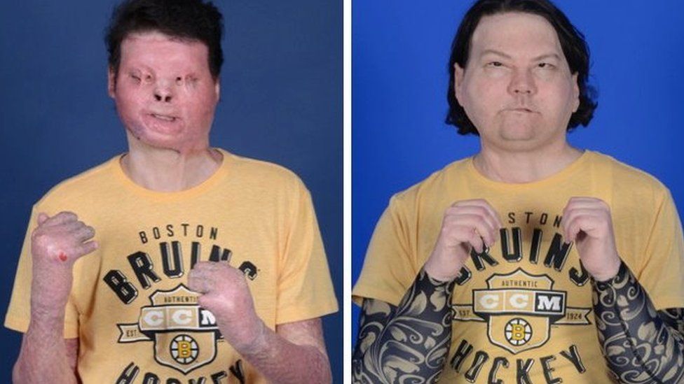 A before and after shot of Joe DiMeo