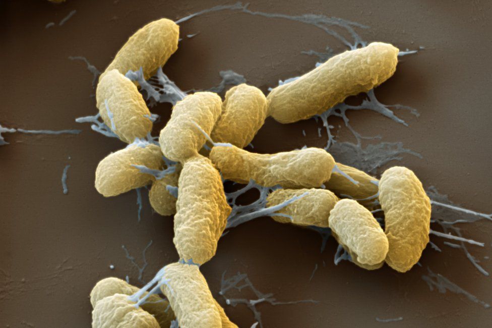 Чума заболевание вызываемые бактериями