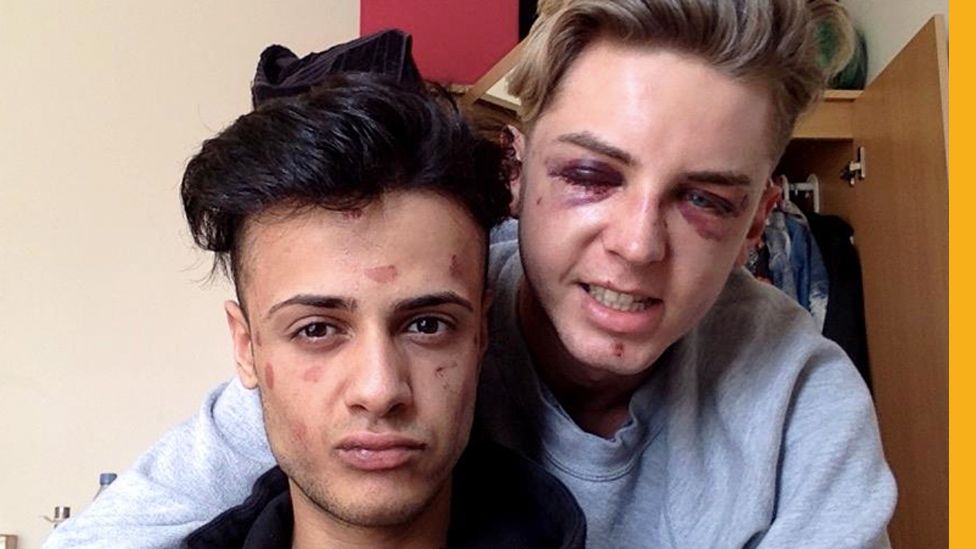 James and Dain after they were attacked