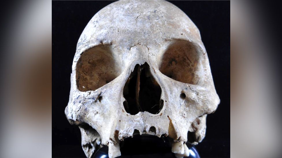 Hoxne skull