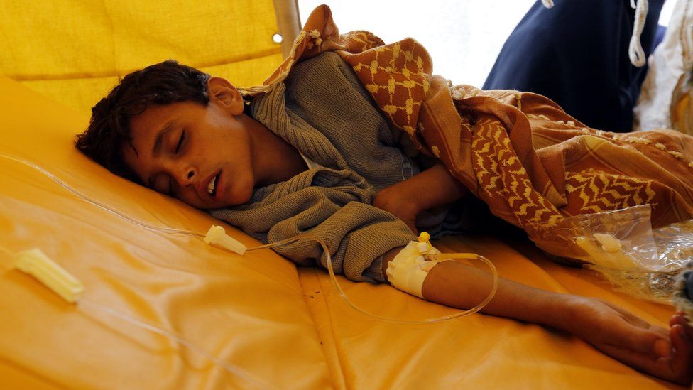 A Yemeni child suspected of being infected with cholera receives treatment inside a tent at a hospital in Sanaa, Yemen (15 June 2017)