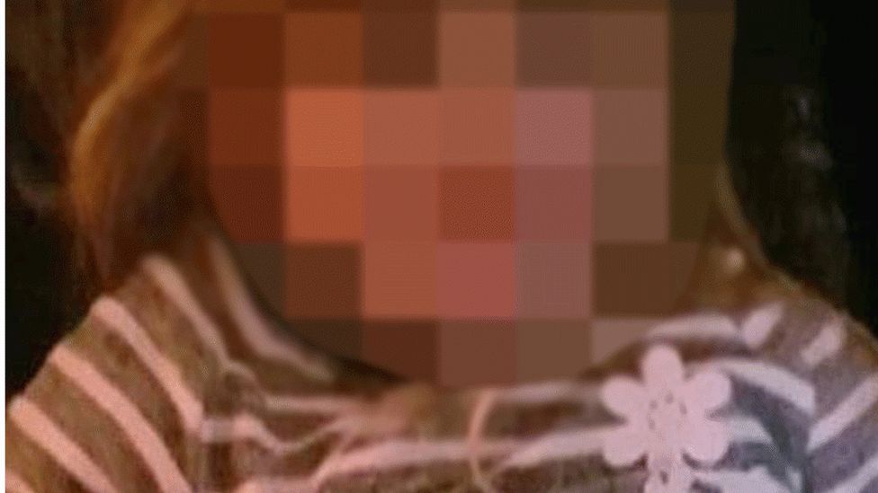 Pixelated image of abused four-year-old