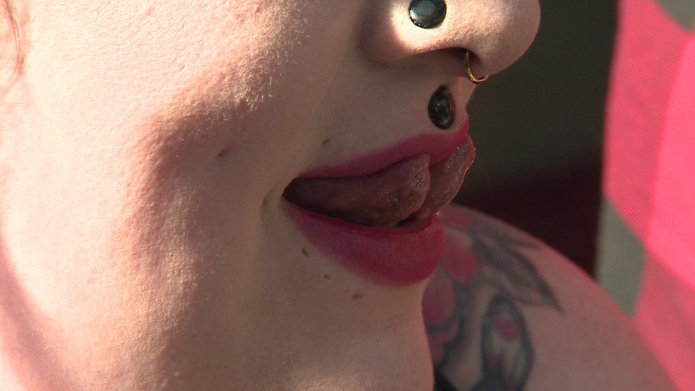 Your tongue splitting Loftus Plastic