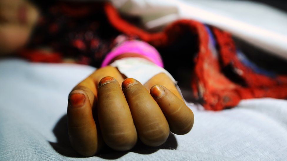 A girl, allegedly raped by a man, lies in a hospital bed