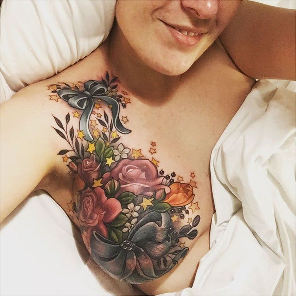 Alison Habbal's breast tattoo post-lumpectomy