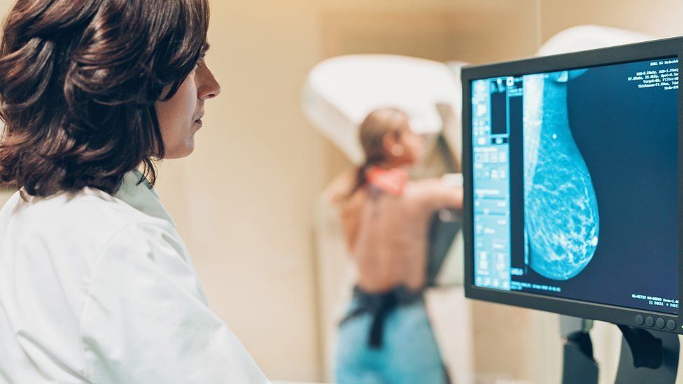 Doctor and patient during a mammography