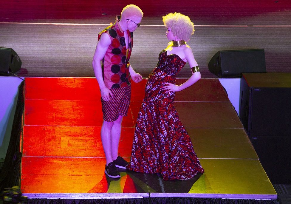 Contestants from Angola pose during the "Mr and Miss Albinism Southern Africa 2023" beauty pageant at the Harare International Conference Centre, in Harare, Zimbabwe, 14 October 2023 (issued 15 October 2023). The pageant, the first of its kind in the world, was held to conscientise the world that people with albinism are the same as every other person, remove stigma and also to end the discrimination and the ritual killings of albinos particularly in Africa.