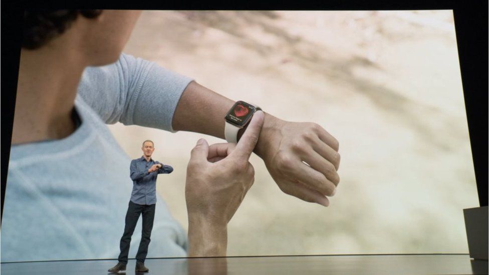 Apple watch ECG