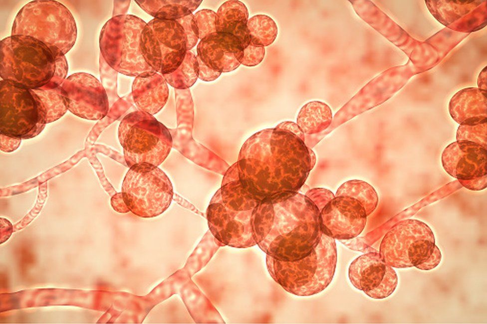 Computer illustration of the unicellular fungus (yeast) Candida auris. C. auris was first identified in 2009. It causes serious multidrug-resistant infections in hospitalized patients and has high mortality rates. It causes bloodstream, wound and ear infections and has also been isolated from respiratory and urine specimens.