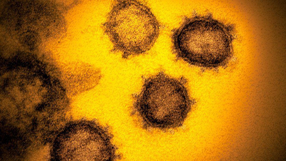 A close-up of the coronavirus which causes Covid-19