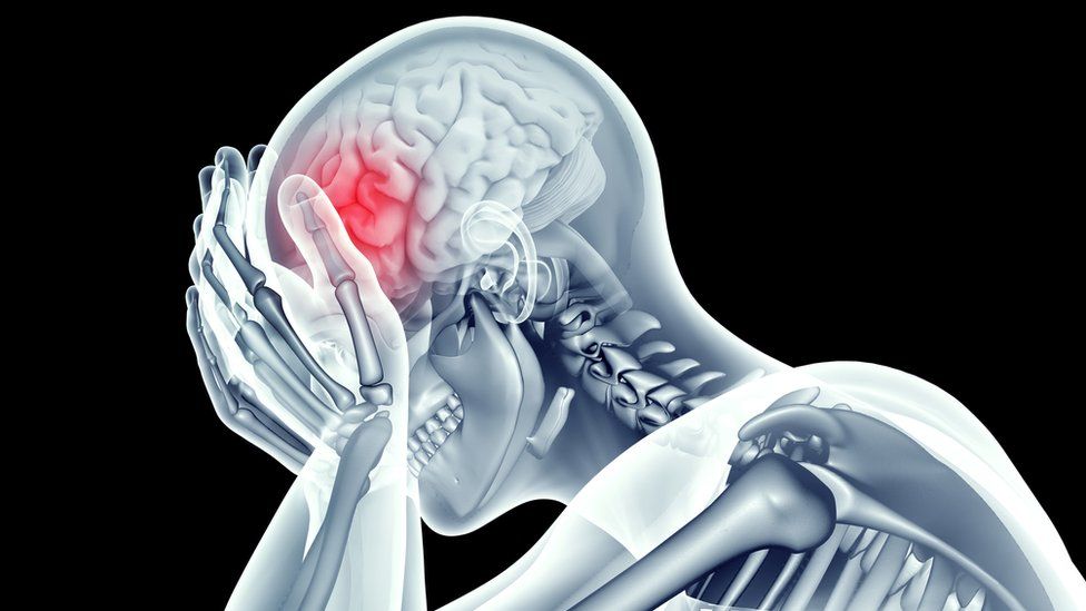 Diferentes lugares de dolor de cabeza y lo que significan