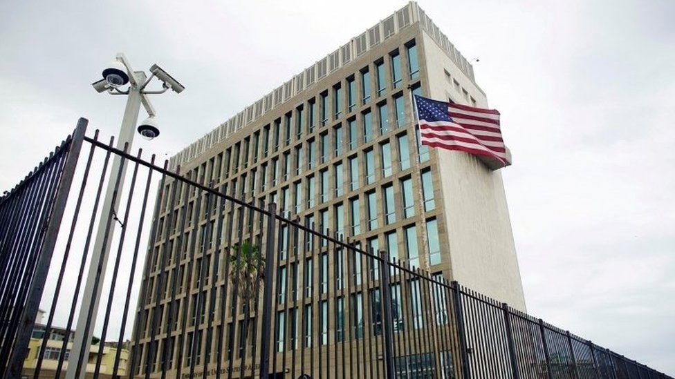 An exterior view of the US embassy in Havana, Cuba, June 19, 2017