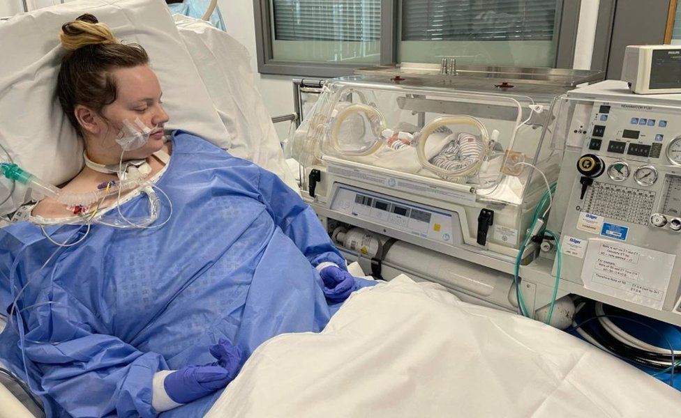 Covid 19 Walsall Coma Mum Inspired To Become ICU Nurse BBC News