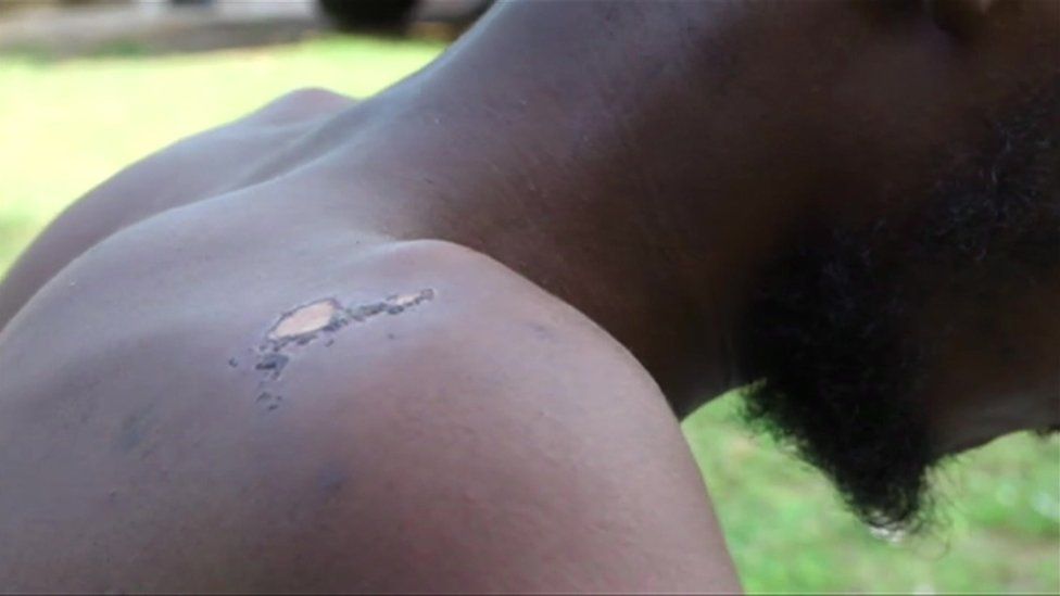 Isa Ibrahim shows scars on his back