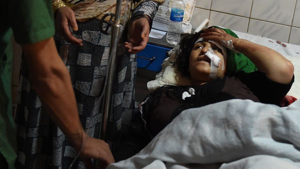 An Afghan woman receives treatment at the Ali Abad hospital after an attack inside the Kart-e- Sakhi shrine in Kabul on 11 October