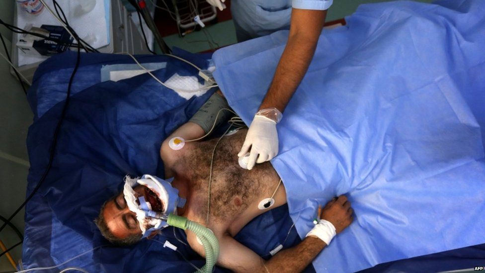 A wounded Iraqi Kurdish man receives treatment at a hospital in Erbil after Turkish air strikes, 2 Aug