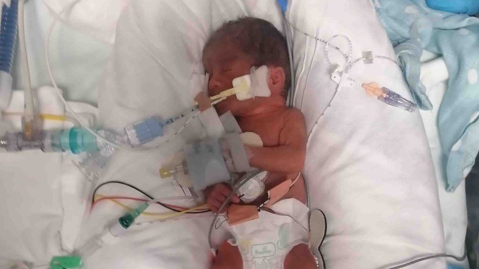 Rohan is neonatal intensive care