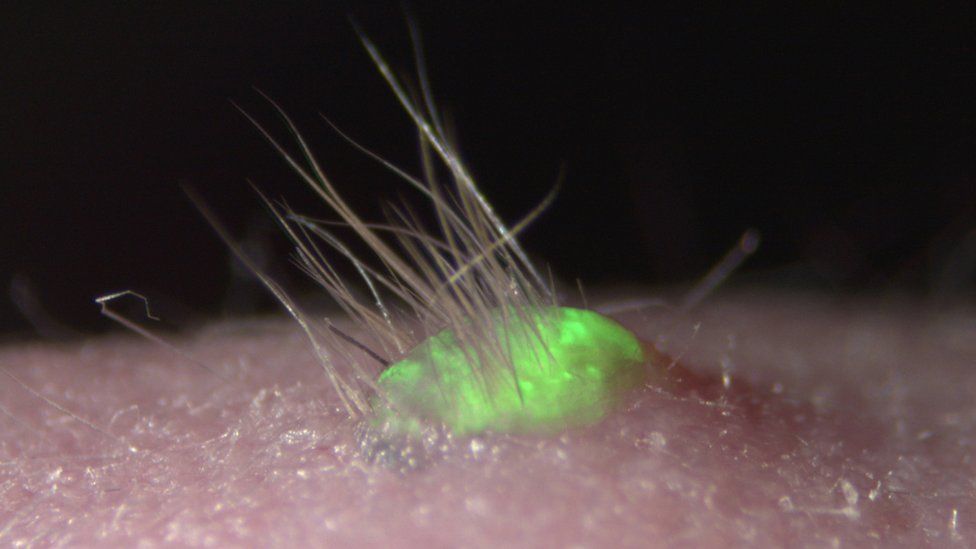 Promising lab-grown skin sprouts hair and grows glands - BBC News