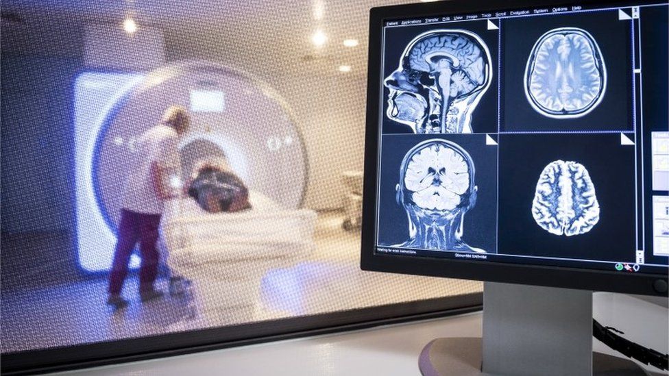 MRI scanning of the brain