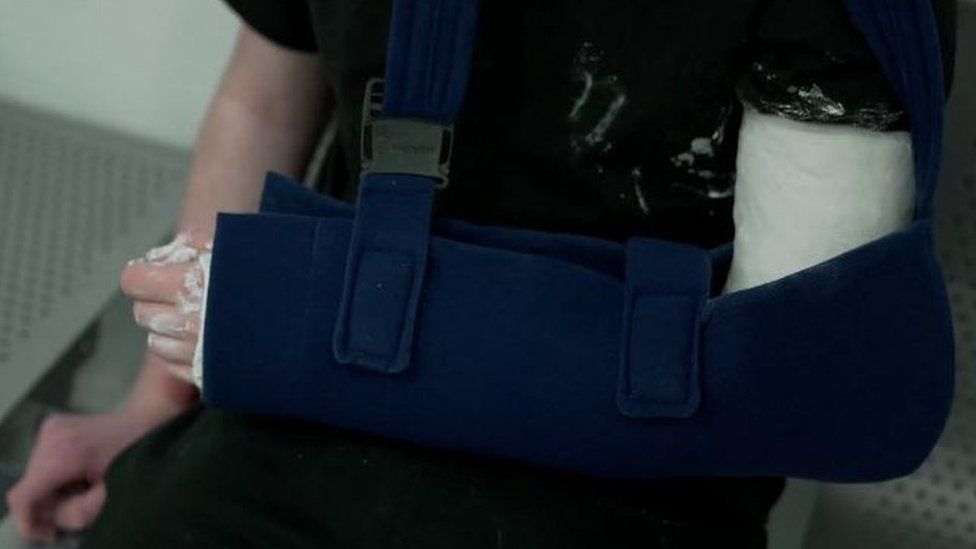 A patient with their arm in a sling