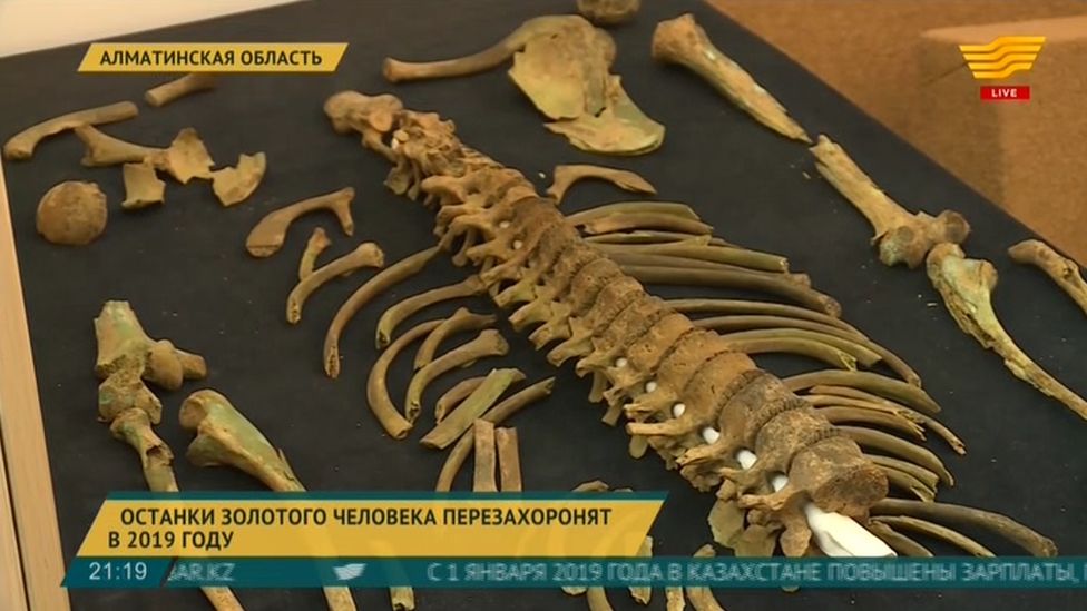 Bones of Kazakh 'Golden Man' relic.