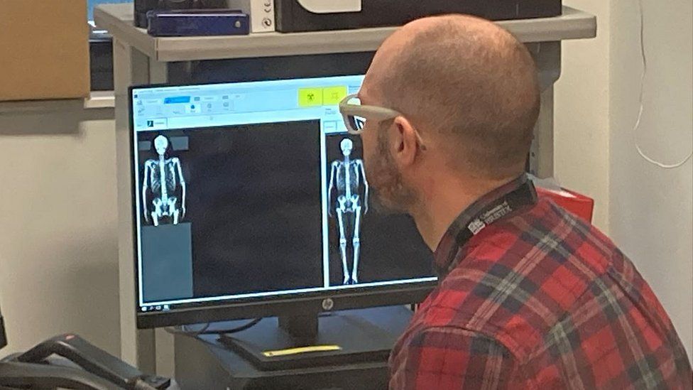 A man looking at a body scan on a computer screen